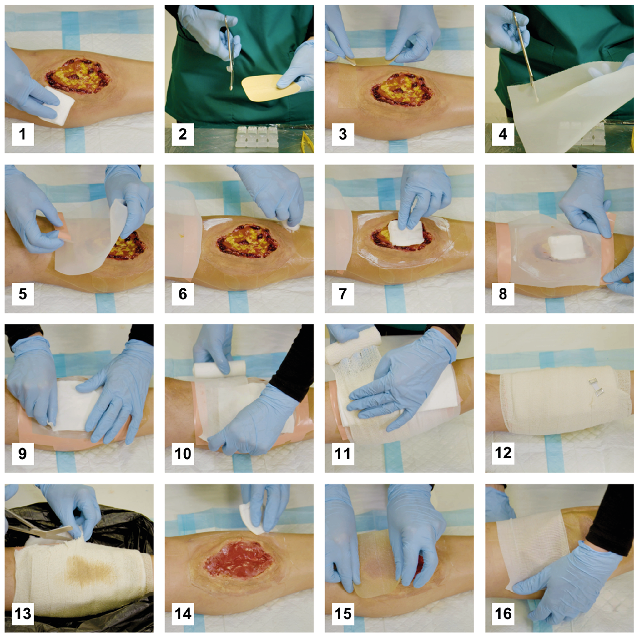 Sixteen photographs (1-16) show step-by-step how to construct a free-range maggot dressing with resources commonly available in modern clinical settings. The caption provides a detailed verbal description of the process.