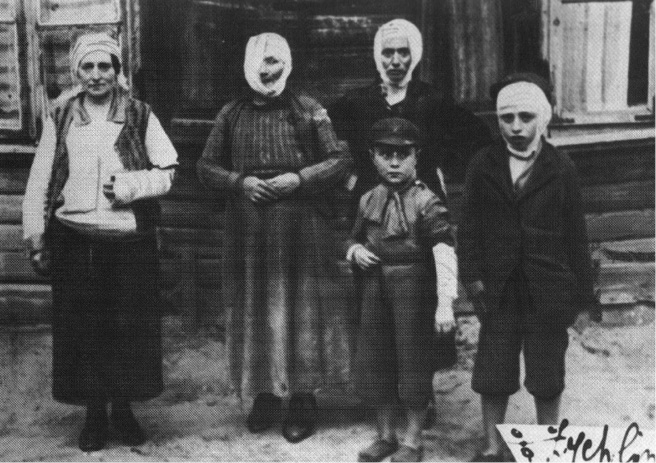 Five victims of the Minsk-Mazovyetsk pogrom, June 1936. The heads of two women and one child are bandaged, as are the arms of one woman and one child.